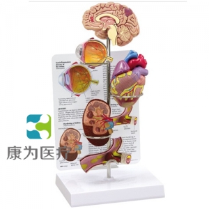 “康為醫(yī)療”醫(yī)患關(guān)系溝通模型-微型腦、眼、心、腎及動(dòng)脈模型 （醫(yī)學(xué)指導(dǎo)模型）
