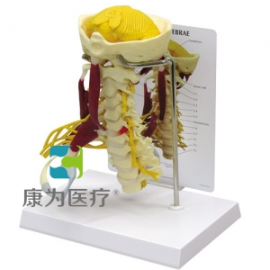 “康為醫(yī)療”醫(yī)患關(guān)系溝通模型-頸椎帶神經(jīng)、肌肉附小腦模型 （醫(yī)學(xué)指導(dǎo)模型）