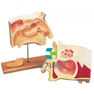 鼻竇內(nèi)窺鏡使用訓(xùn)練模型，2部分-德文注釋