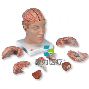 豪華型腦模型帶顱底動脈，8部分