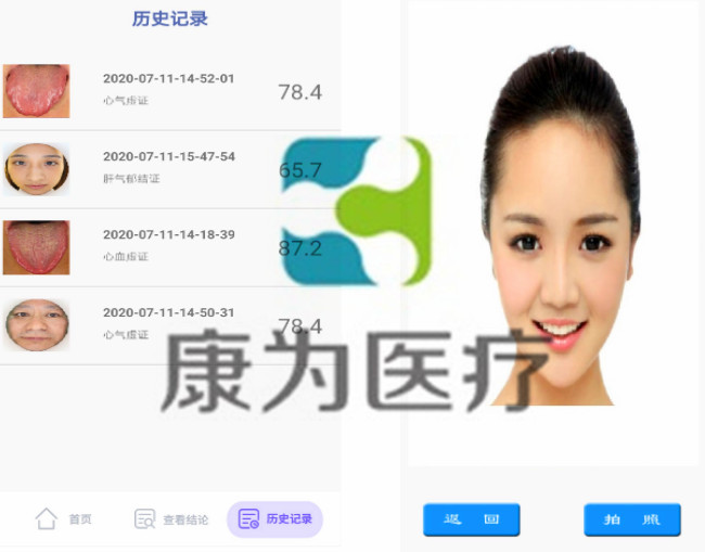 KANGWAY云中醫(yī)智能鏡生產廠家