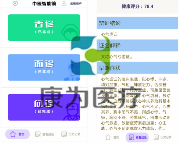 KANGWAY云中醫(yī)智能鏡生產廠家